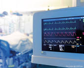 Monitor che visualizza i valori vitali in una corsia di ospedale (Foto Sudok1@123RF.com)
